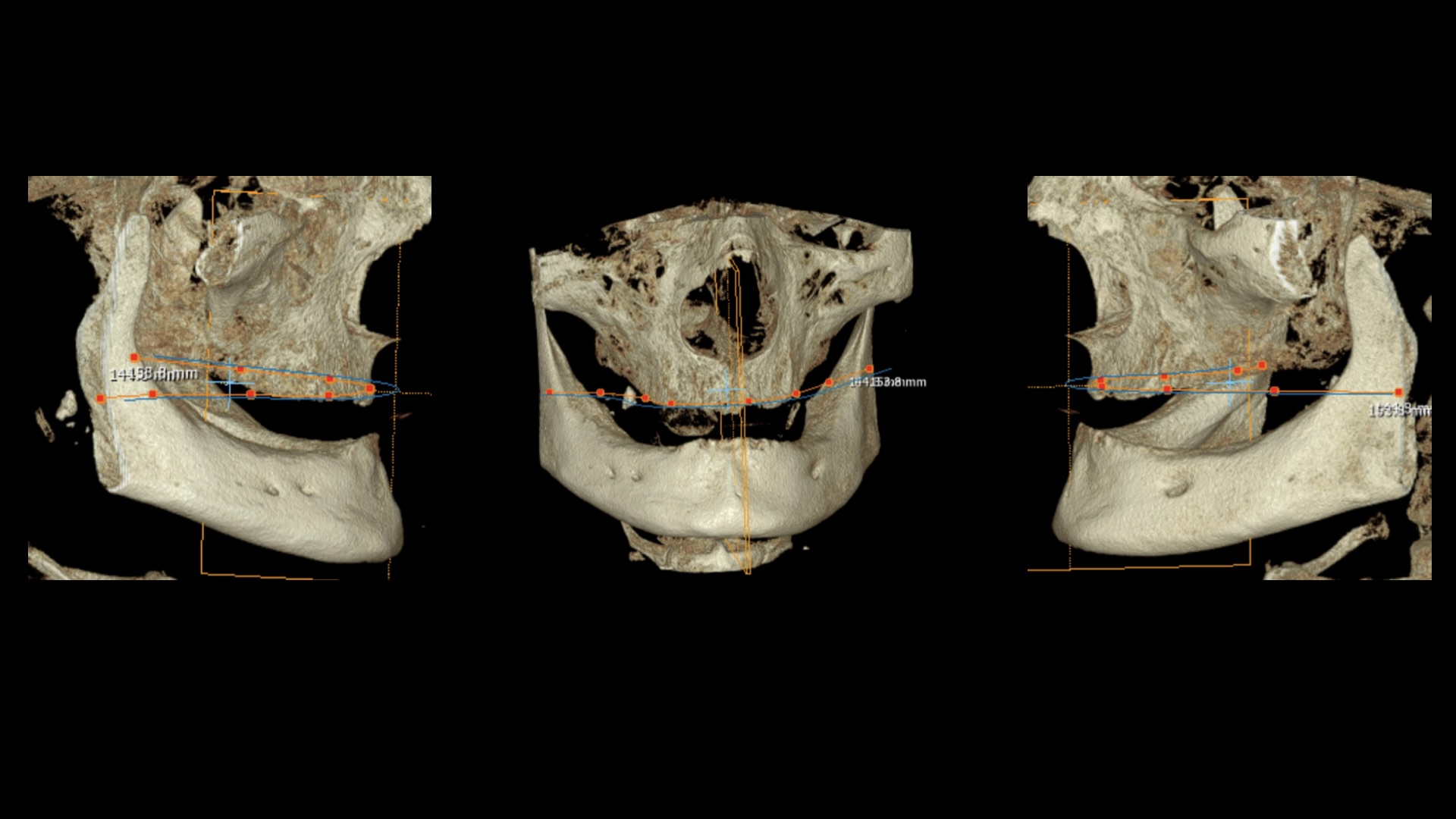 Clinical View 2